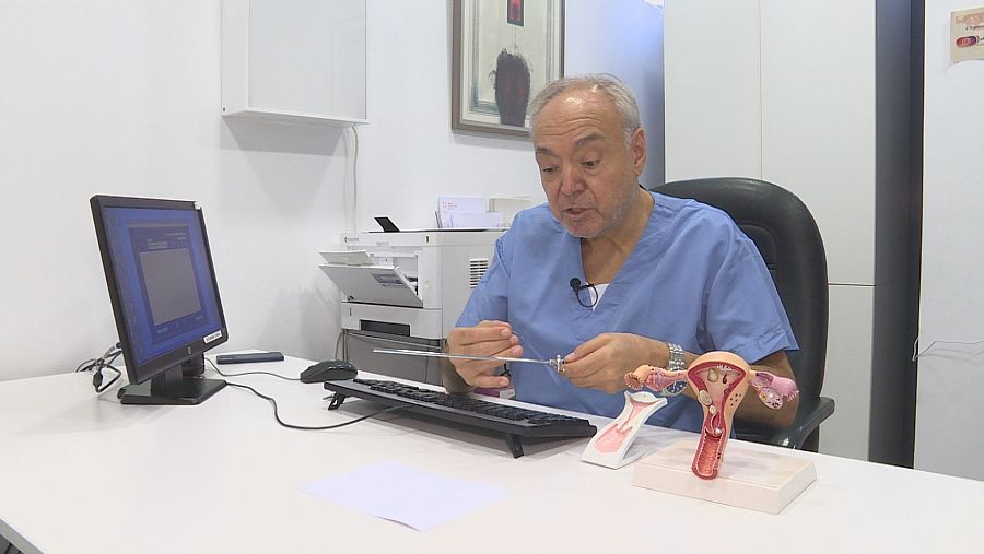 El ginecólogo Enric Cayuela fue pionero en la técnica del Essure en España