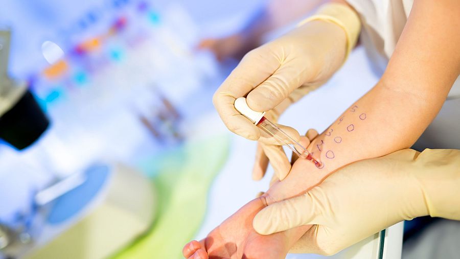Pinchazo en la piel para averiguar el tipo de alergia que se padece - Ver ahora