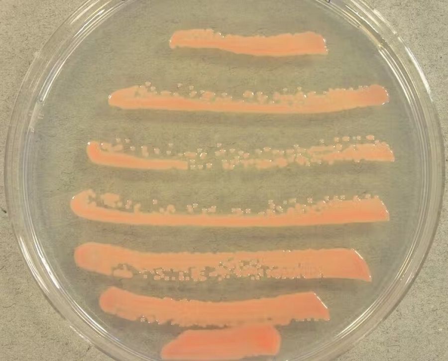 Colonias de 'Rhodotorula glutinis'