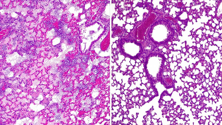 A la izquierda, pulmones de ratón sin píldora activa; a la derecha, con píldora viva activa combatiendo a 'P. aeruginosa'