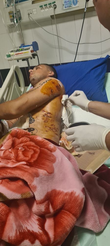 Ashkan Morovati, atendido de las heridas de bala en el hospital.
