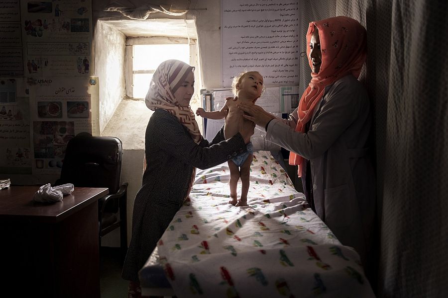 Hojatullah, un niño de 11 meses que sufre malnutrición, examinado en una pequeña clínica en Alibeg (Afgansitán)