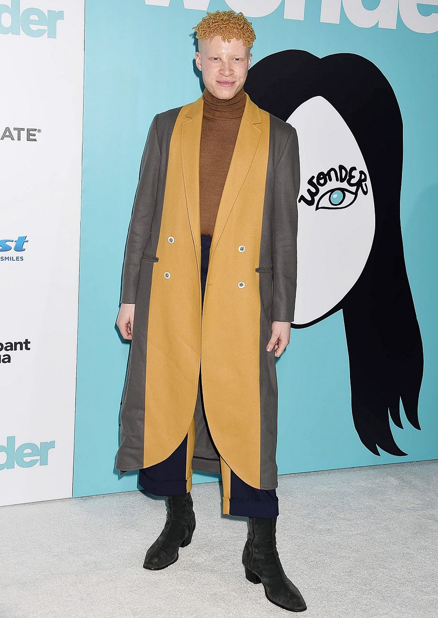 Shaun Ross, actor y bailarín estadounidense conocido por ser el primer modelo albino masculino