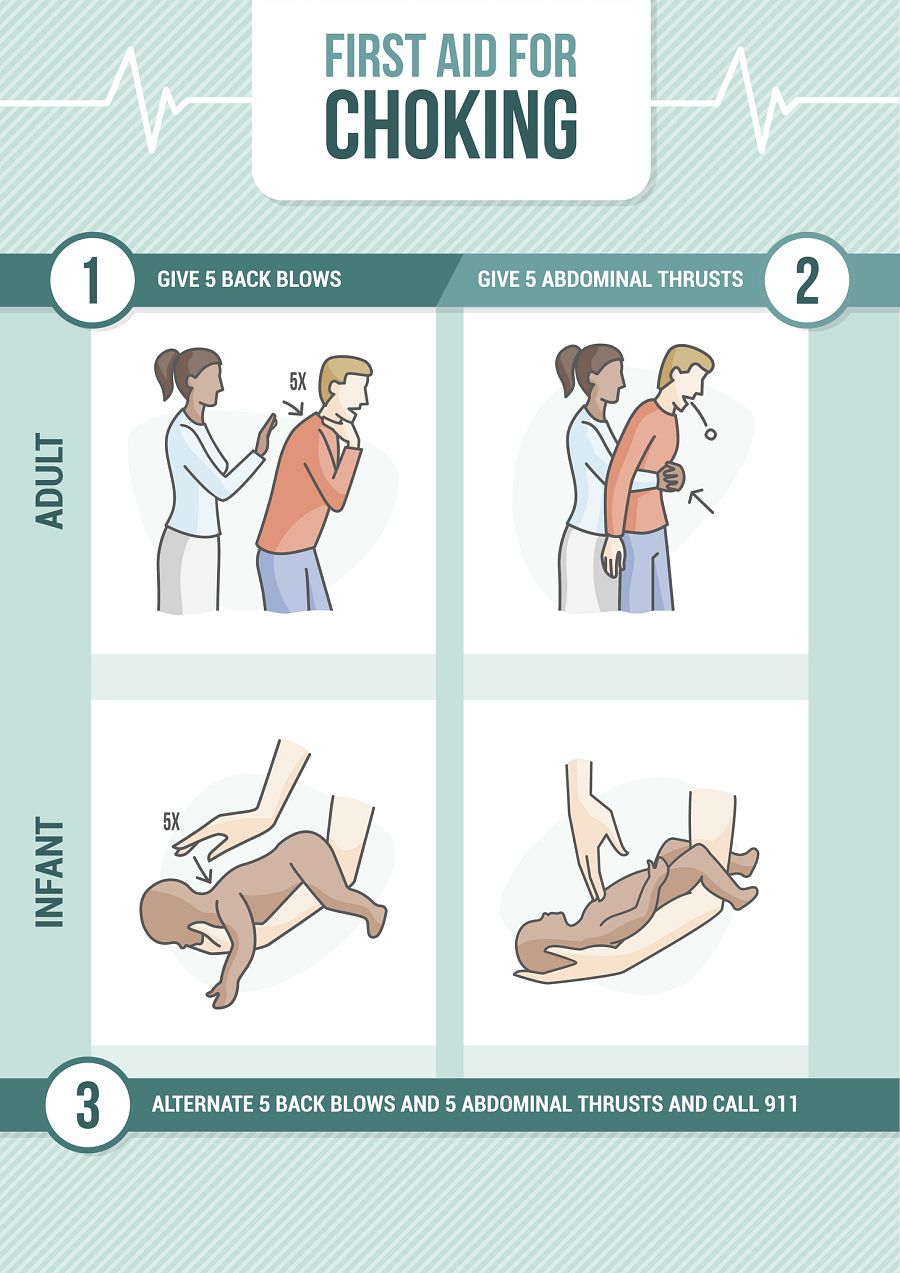Choking first aid