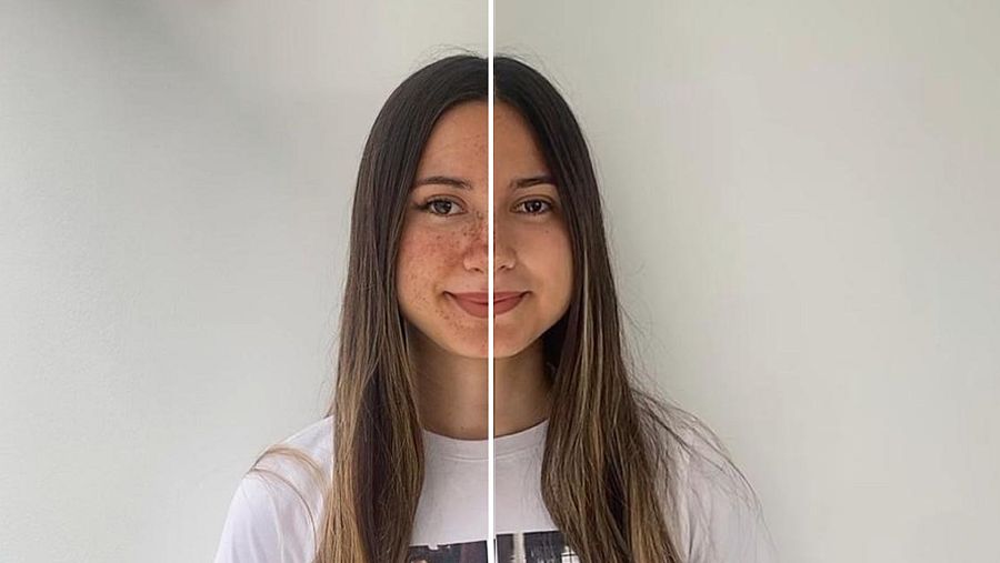 Una chica con una línea divisoria en su cara. Un lado tiene aplicado el filtro 'Real freckles with lashes' y el otro lado no tiene ningún filtro.