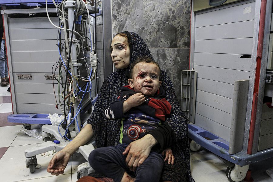 Una madre con la mirada perdida sostiene a su hijo en brazos instantes después del bombardeo