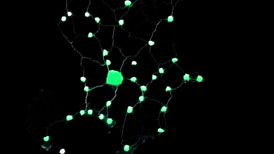 Imagen del hongo P. Polycephalum