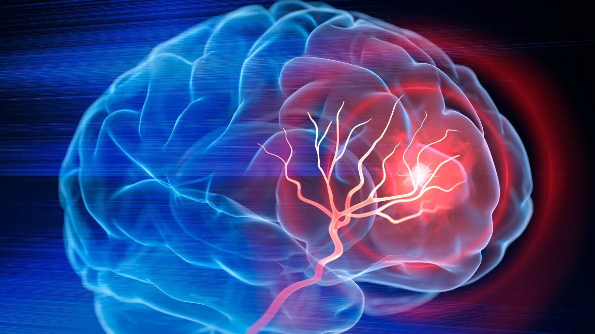 Neuroplasticidad: El poder transformador del cerebro