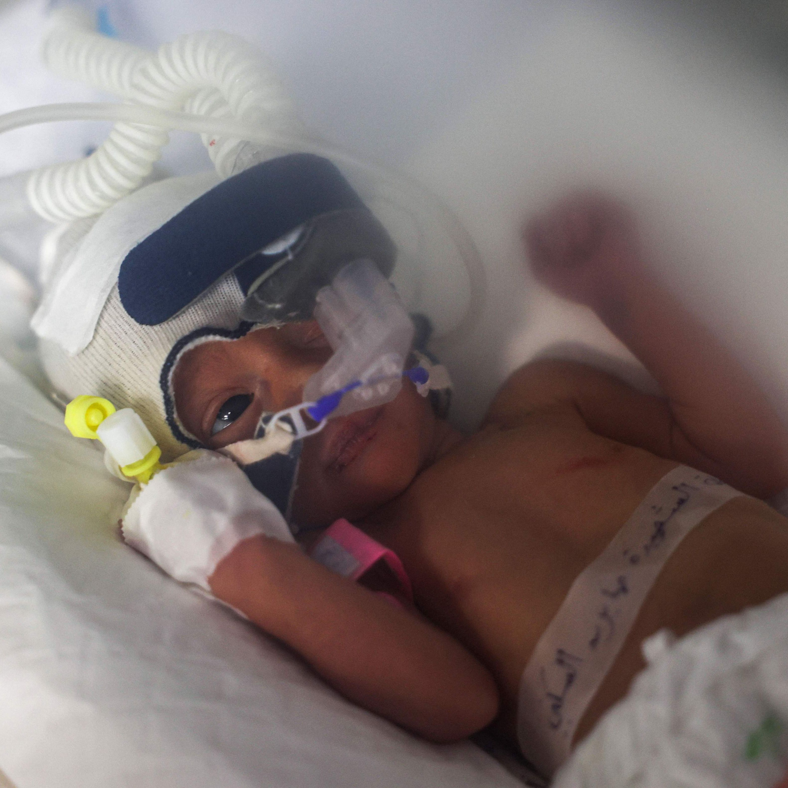 Crónica internacional –  Enfermos crónicos y embarazadas, sin atención médica en Gaza