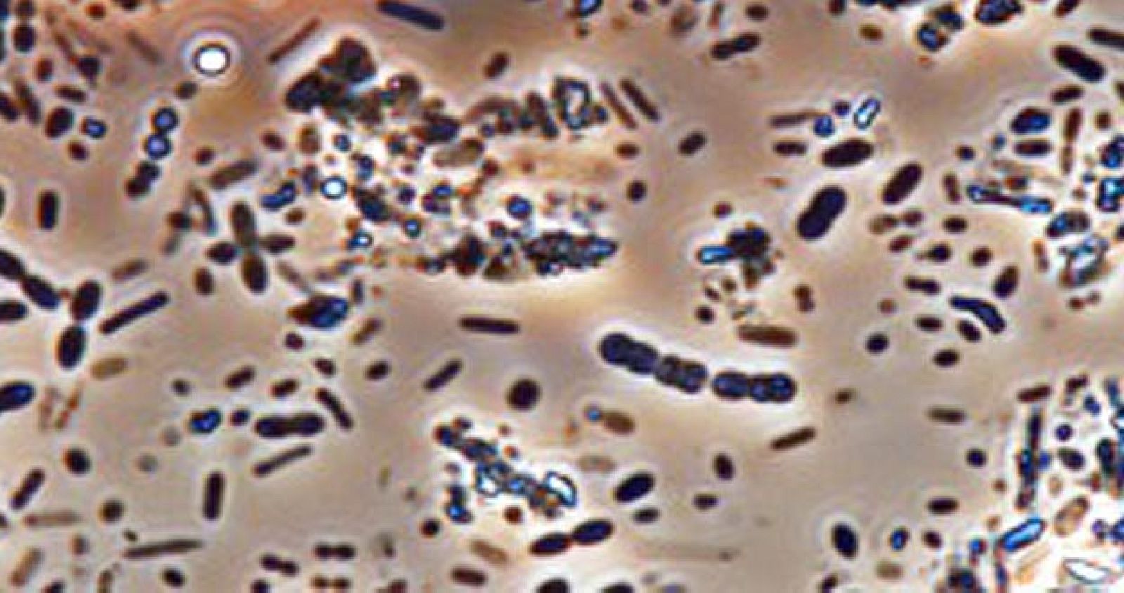 Fotografía de muestra de microbiota de heces humanas