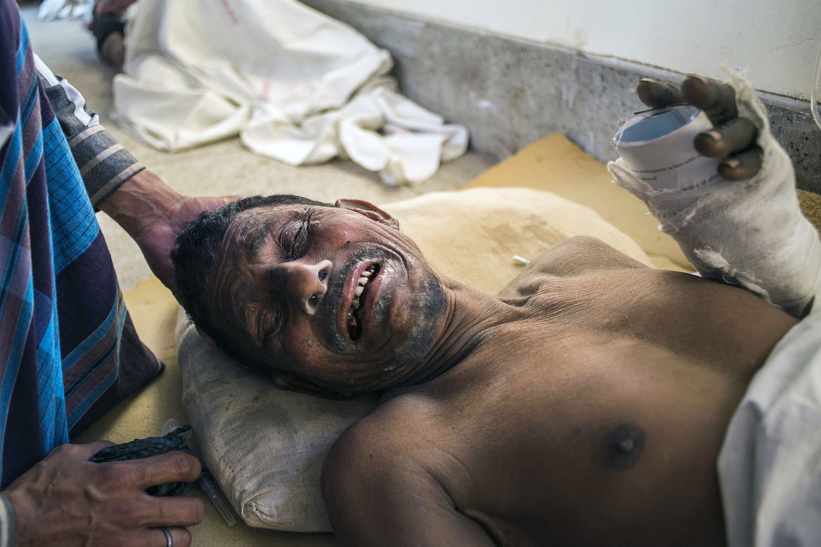 Uno de los heridos del derrumbe de una fábrica en Mongla, Bangladesh