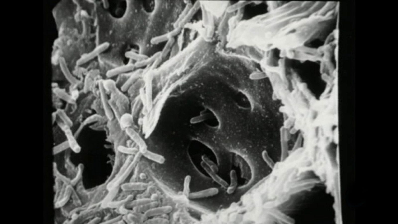 Imagen microscópica de la bacteria Xylella fastidiosa