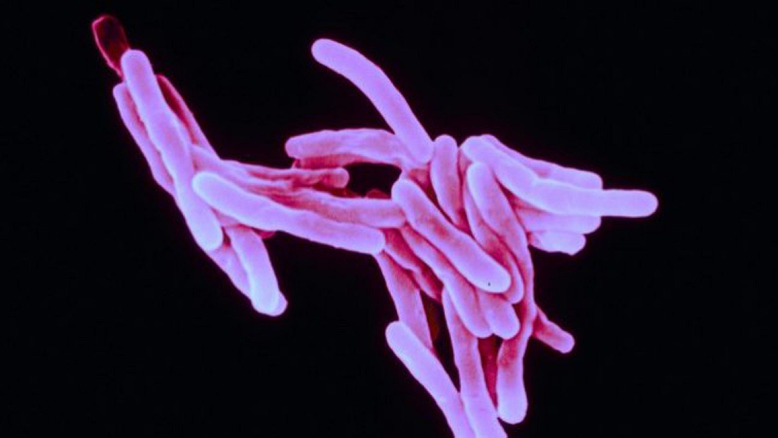 Imagen de la bacteria causante de la tuberculosis
