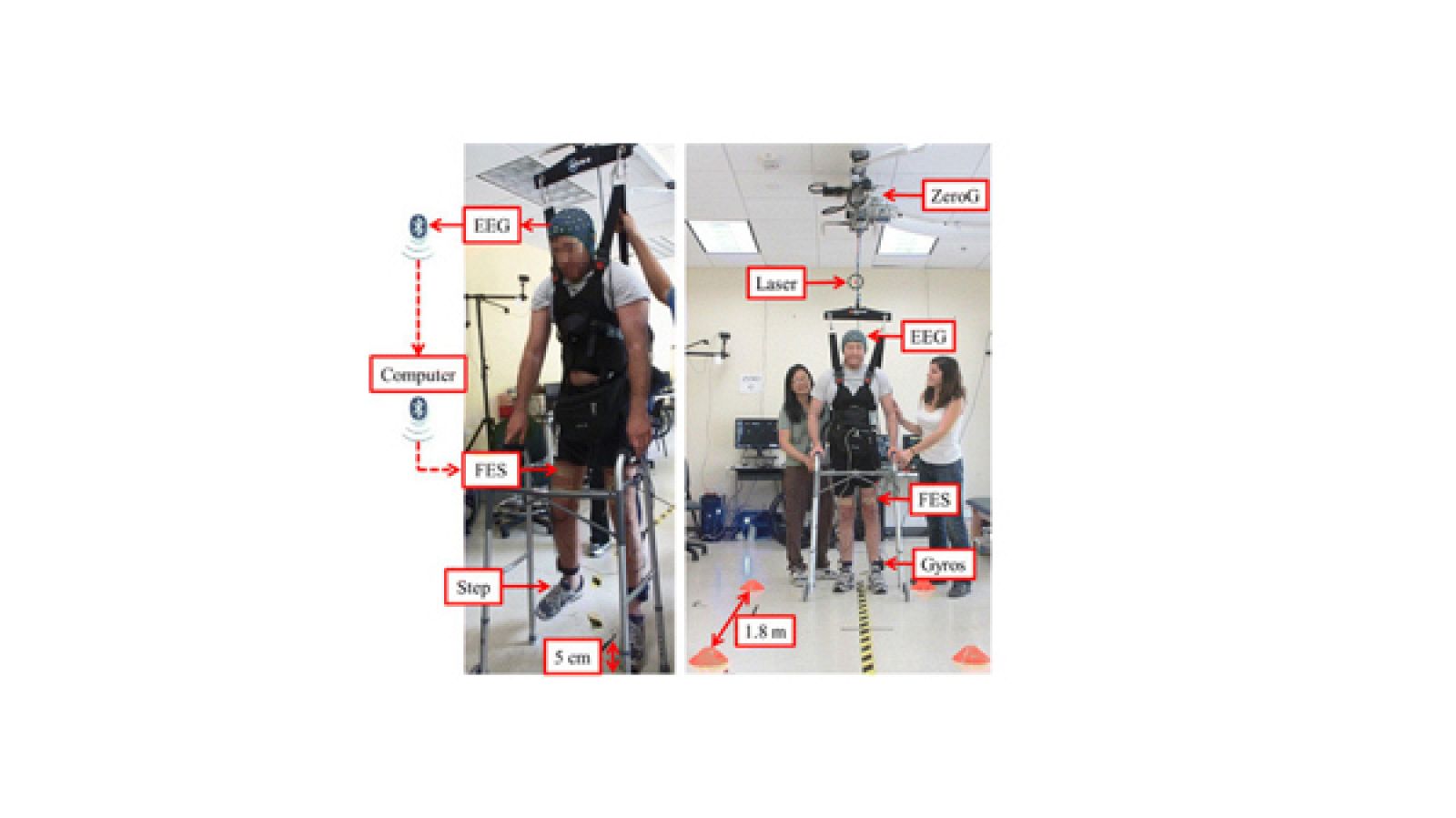 El experimento se ha probado en un hombre de 26 años que llevaba cinco años en una silla de ruedas.