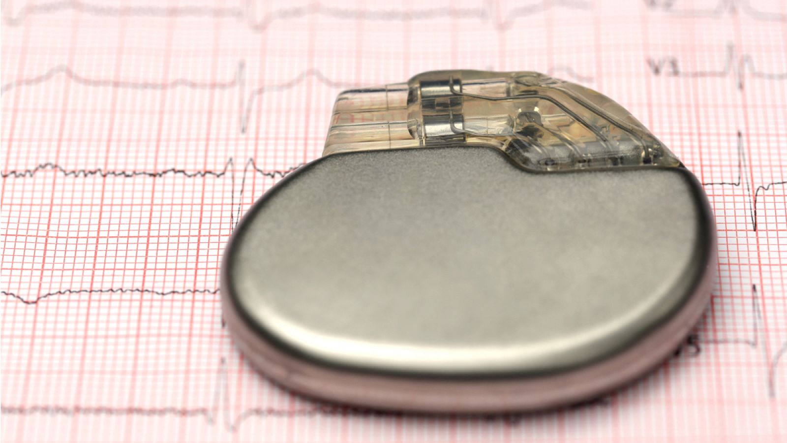 Los actuales marcapasos han disminuido su tamaño y han aumentado su fiabilidad y autonomía.