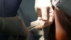 Una punción lumbar permitirá el diagnóstico precoz de tumores cerebrales