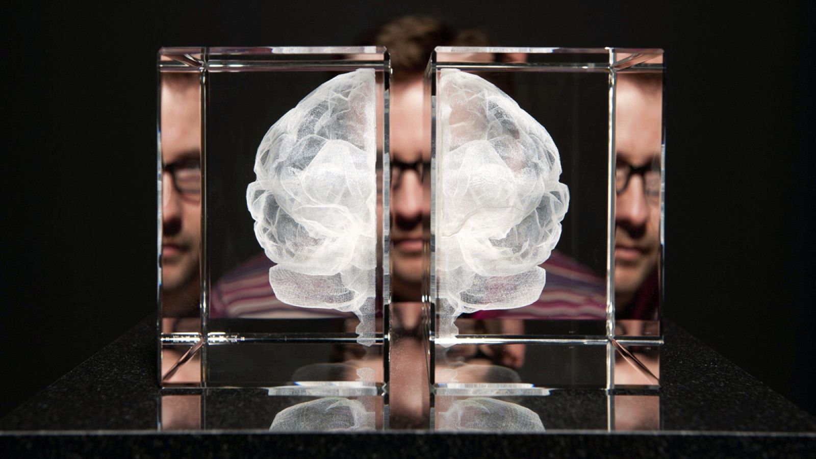 La estimulación cerebral profunda consiste en aplicar electricidad directamente a la corteza cerebral.