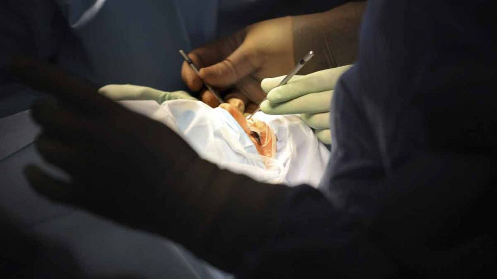 El paciente al que le implantarán los dispositivos de visión artificial es  sordo y ciego.