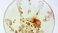 Bacterias en la mano de una niña, la imagen ganadora de Fotciencia