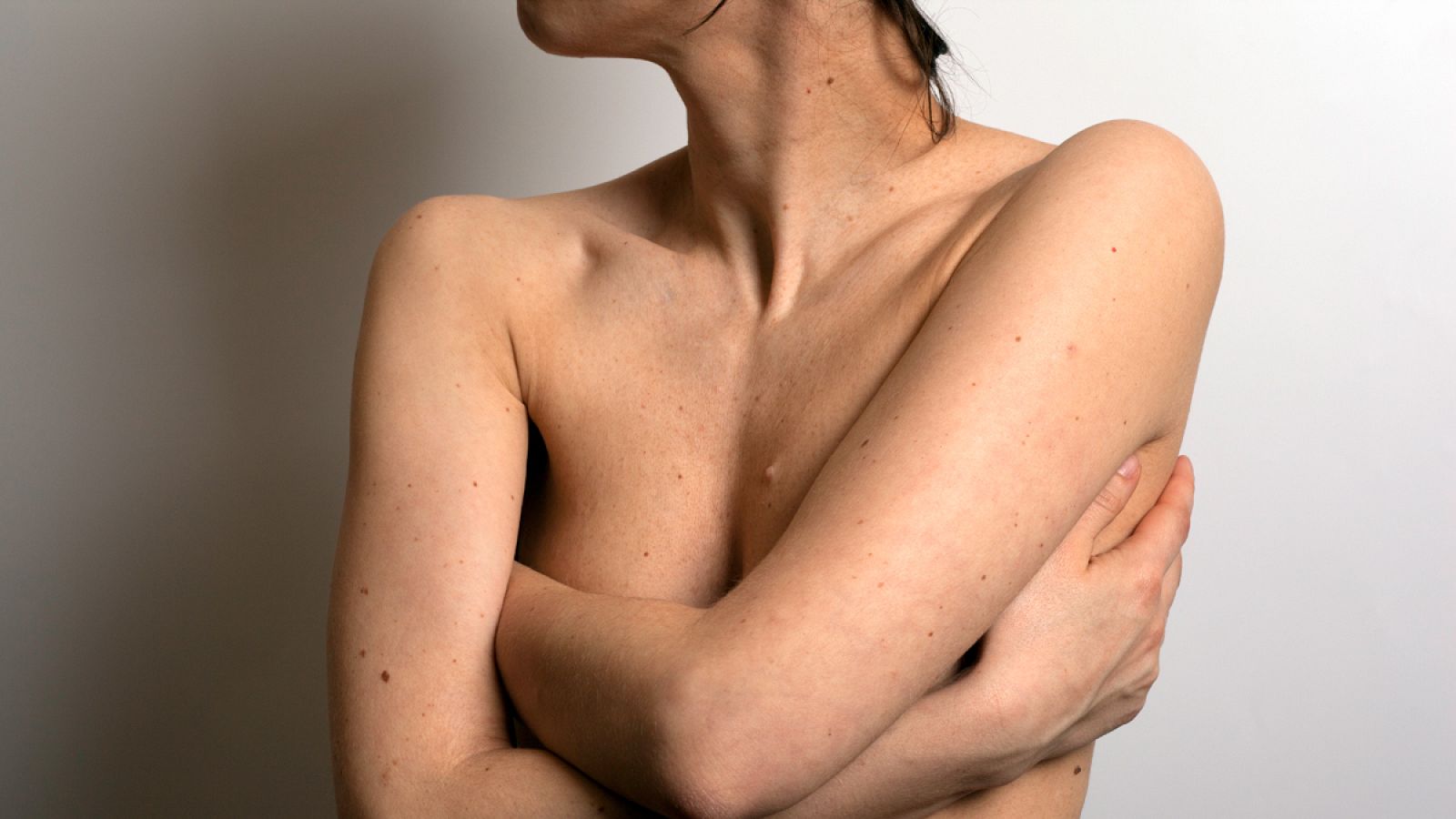 El estudio se ha realizado con 957 pacientes, una de las mayores series publicadas hasta ahora.