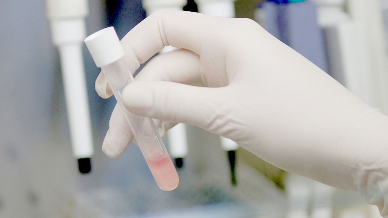 Las terapias dirigidas han supuesto un paso de gigante en los tratamientos oncológicos.