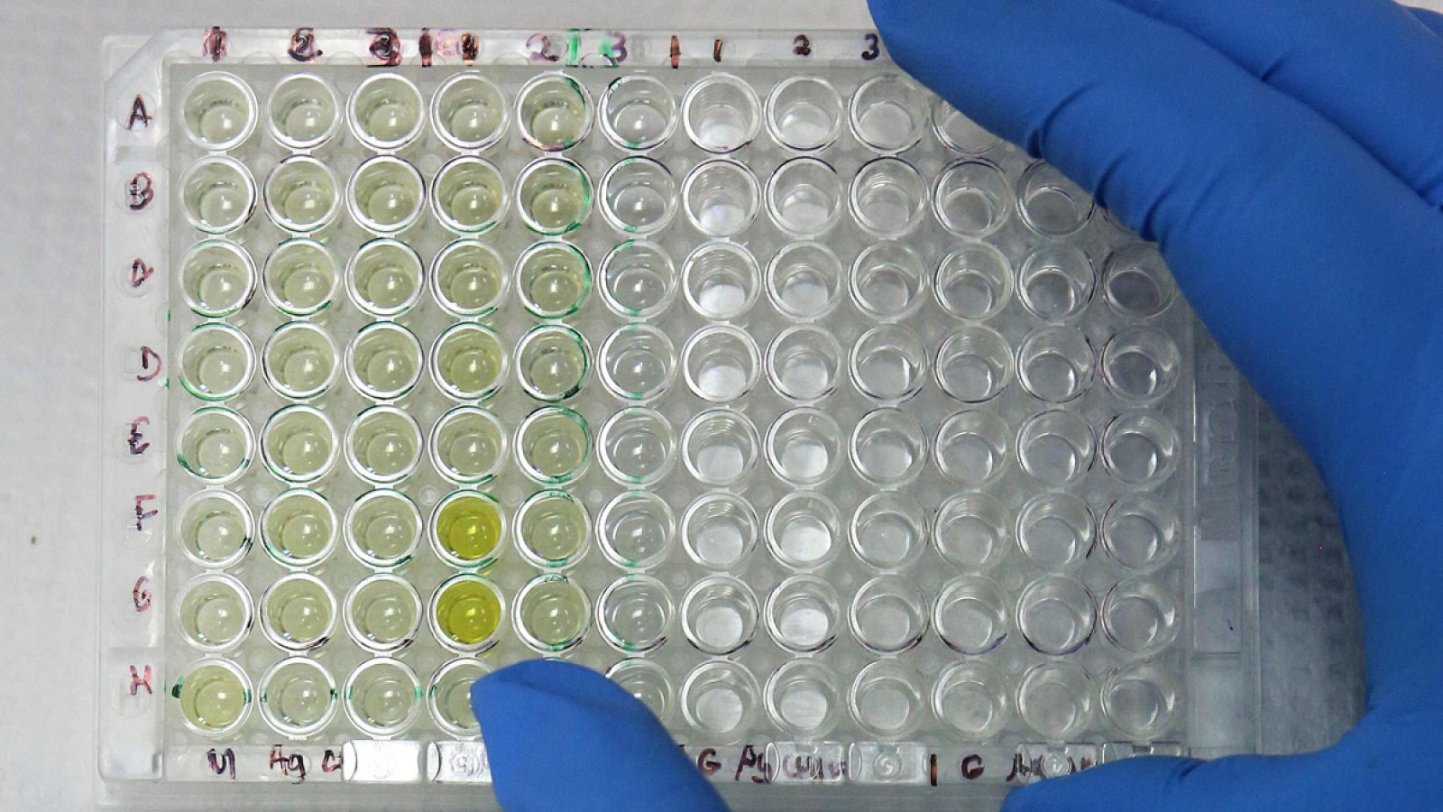 Muestras médicas en un laboratorio.