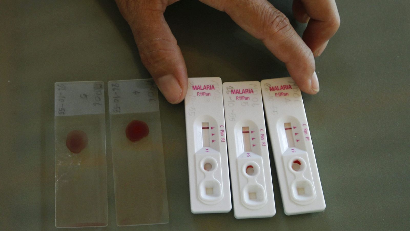 En 2015 se produjeron 438.000 muertes relacionadas con la malaria o paludismo en el mundo.