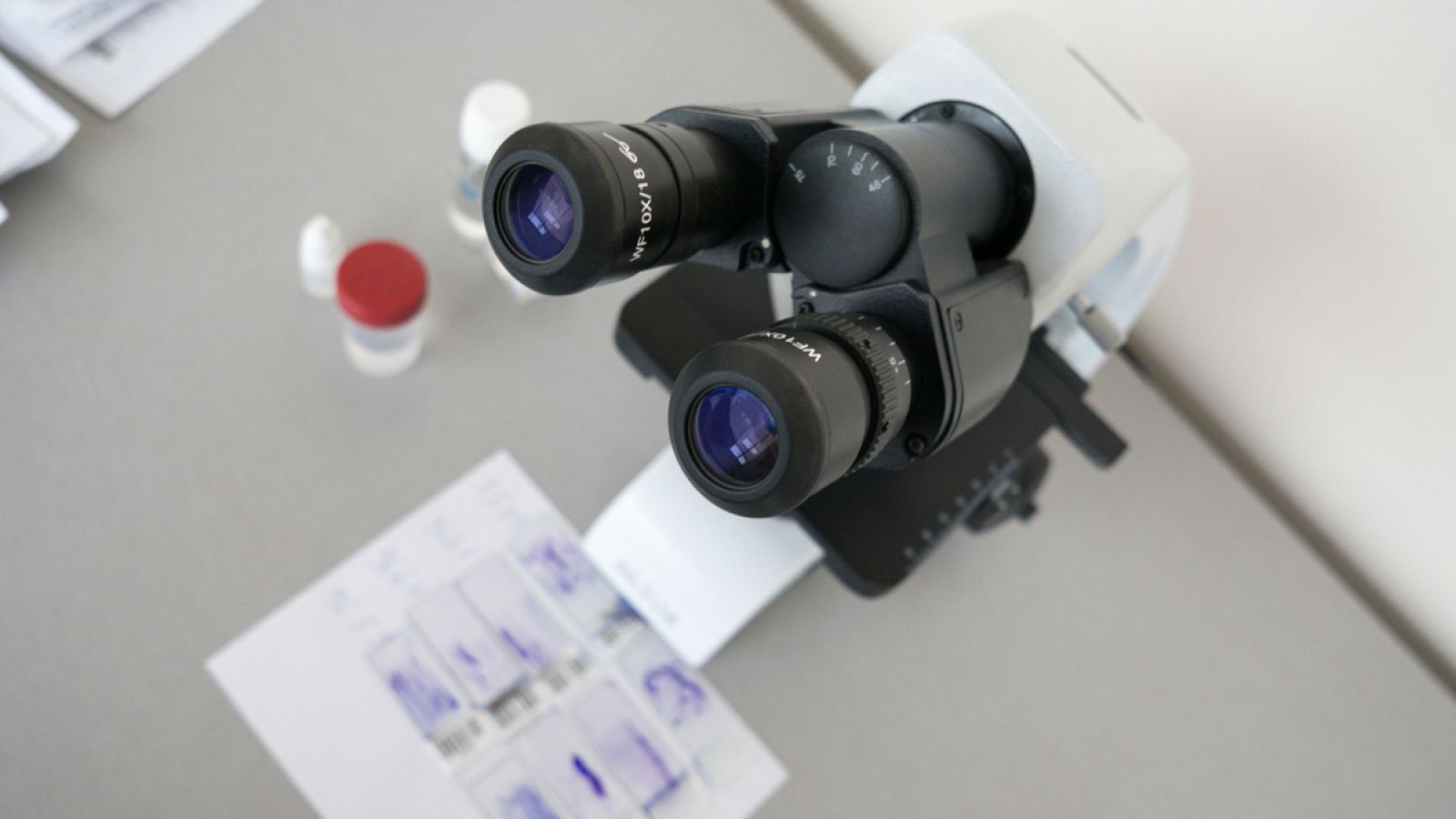 El nuevo test permitirá mejorar la atención a los pacientes con cáncer de colon que estén recibiendo la terapia anti-EGFR.