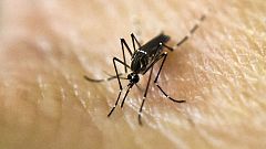 Detectado el primer caso en España de un feto con microcefalia por zika
