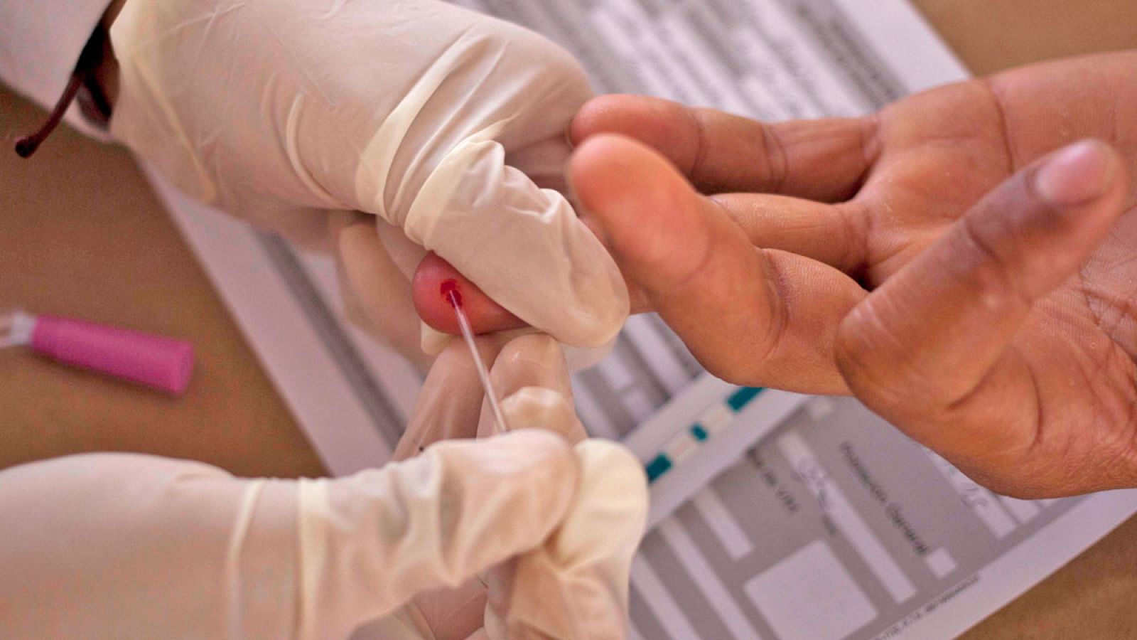 El número de muertes por sida baja un 26% en los últimos cinco años gracias a los antiretrovirales