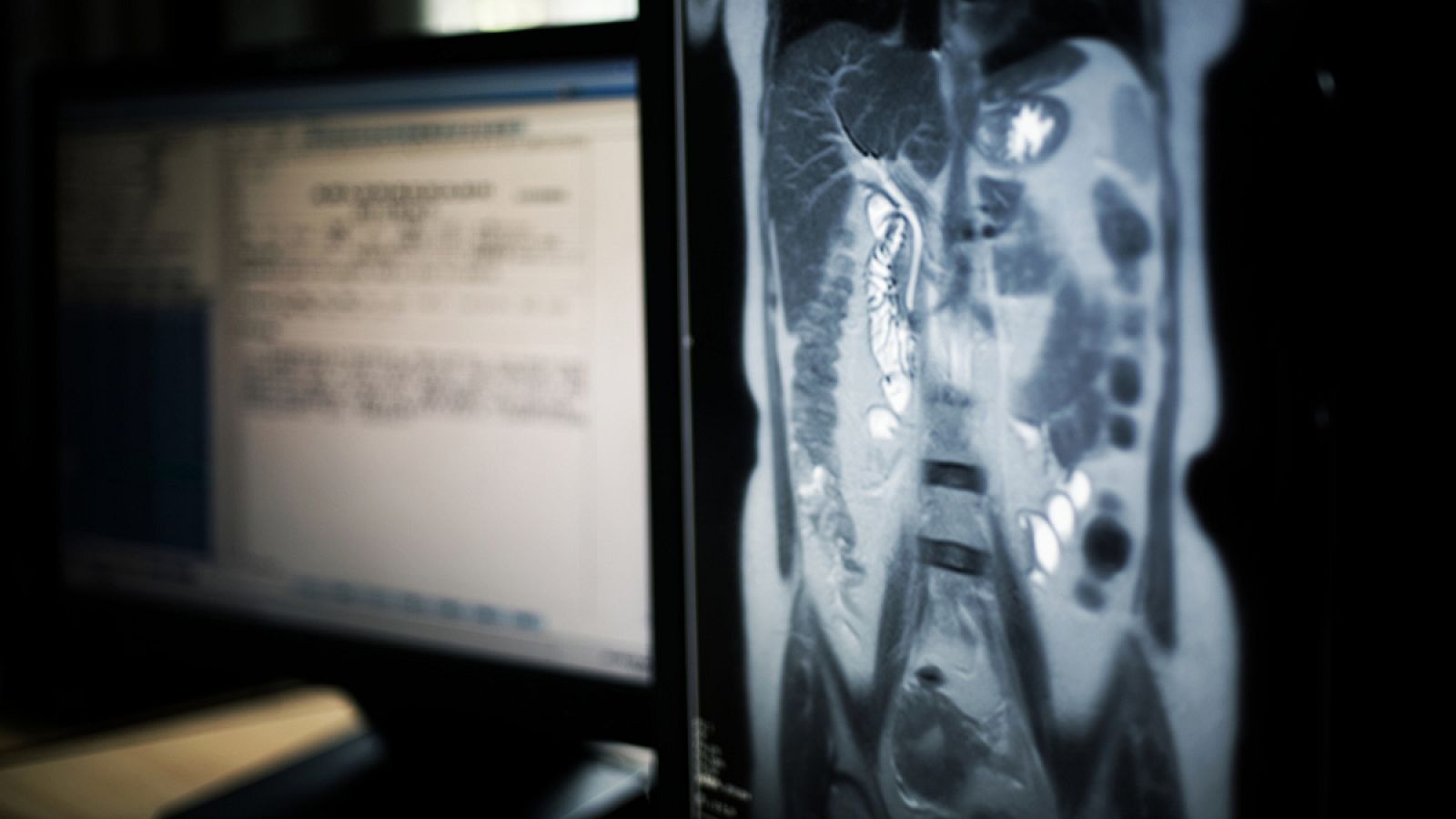 La inmunoterapia gana cada vez mayor peso entre los tratamientos oncológicos.