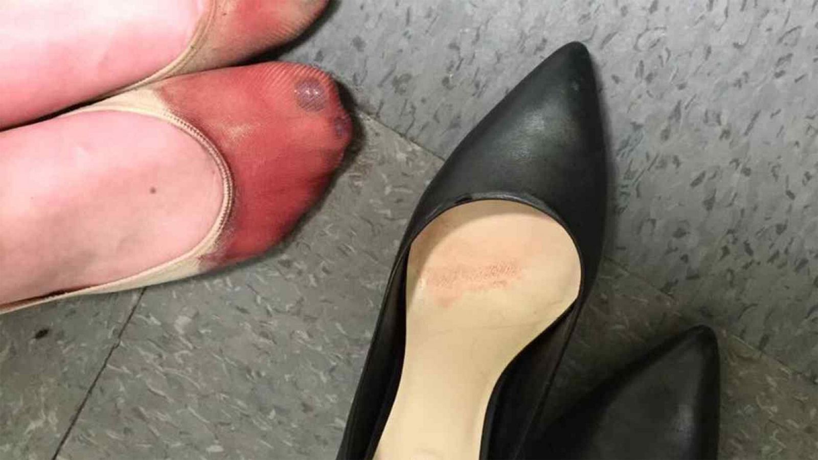 Imagen compartida en Facebook de una camarera tras una jornada laboral con tacones.