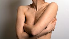 El 85% de las mujeres con cáncer de mama sobrevive al menos cinco años después del diagnóstico