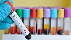 En España hay diagnosticados 85.000 casos de sida