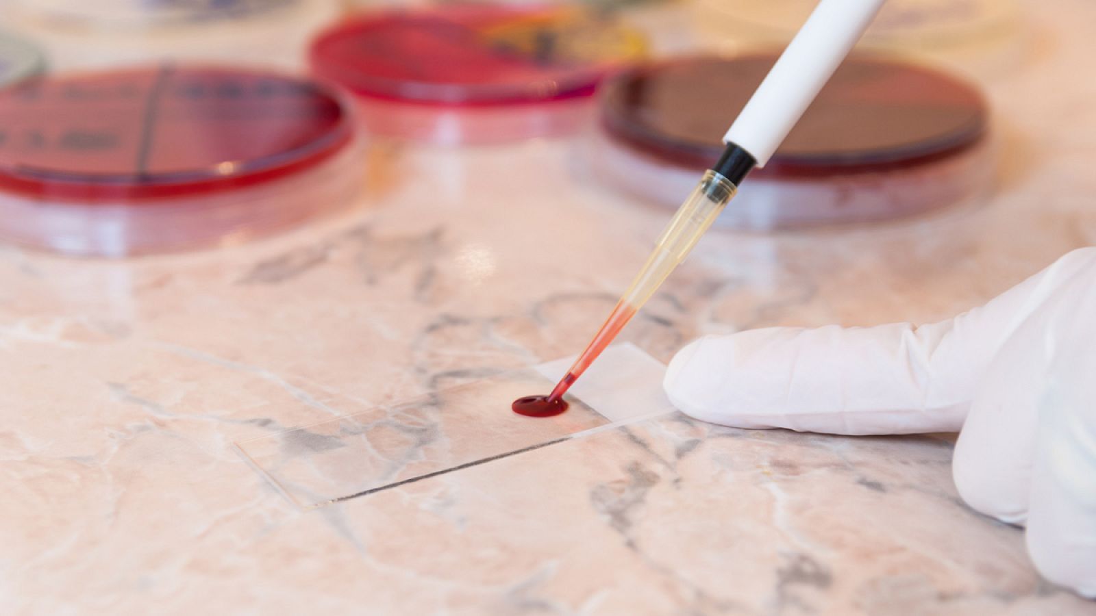 El estudio se ha basado en análisis de sangre a pacientes de Camboya, Laos, Tailandia y Birmania.