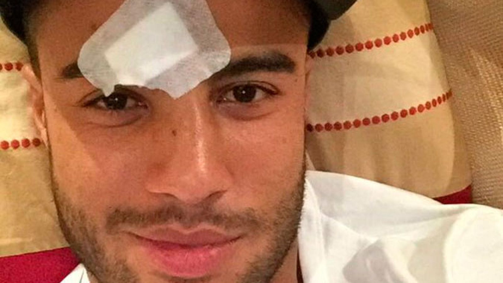 Rafinha sufre una fractura nasal