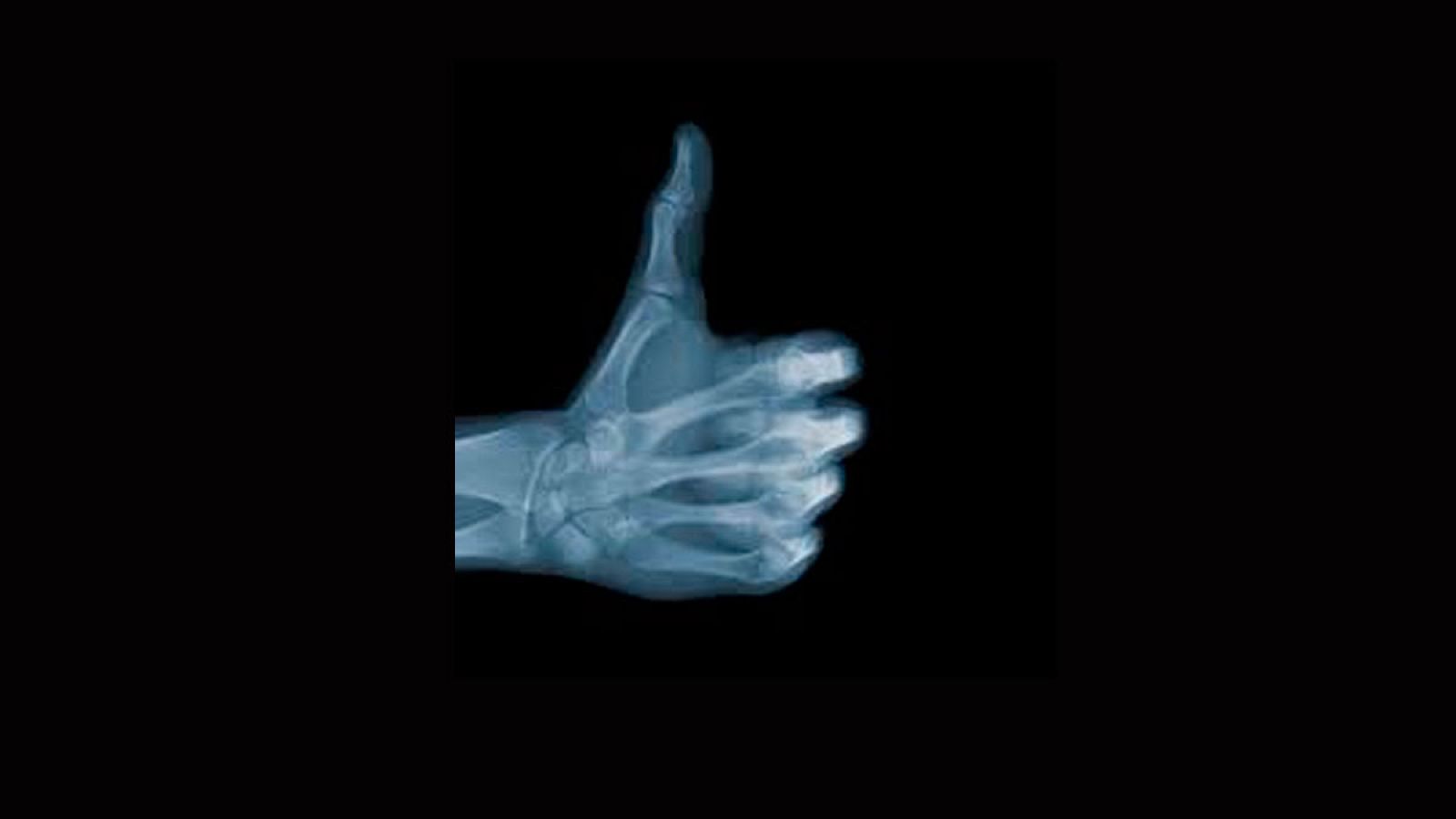 Los Rayos X se descubrieron por casualidad