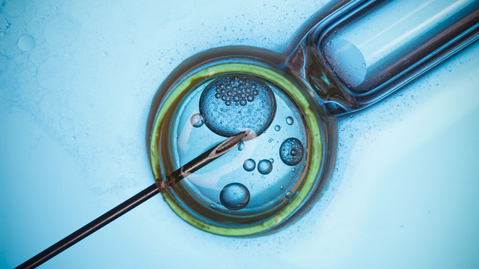 Fecundación 'in vitro'