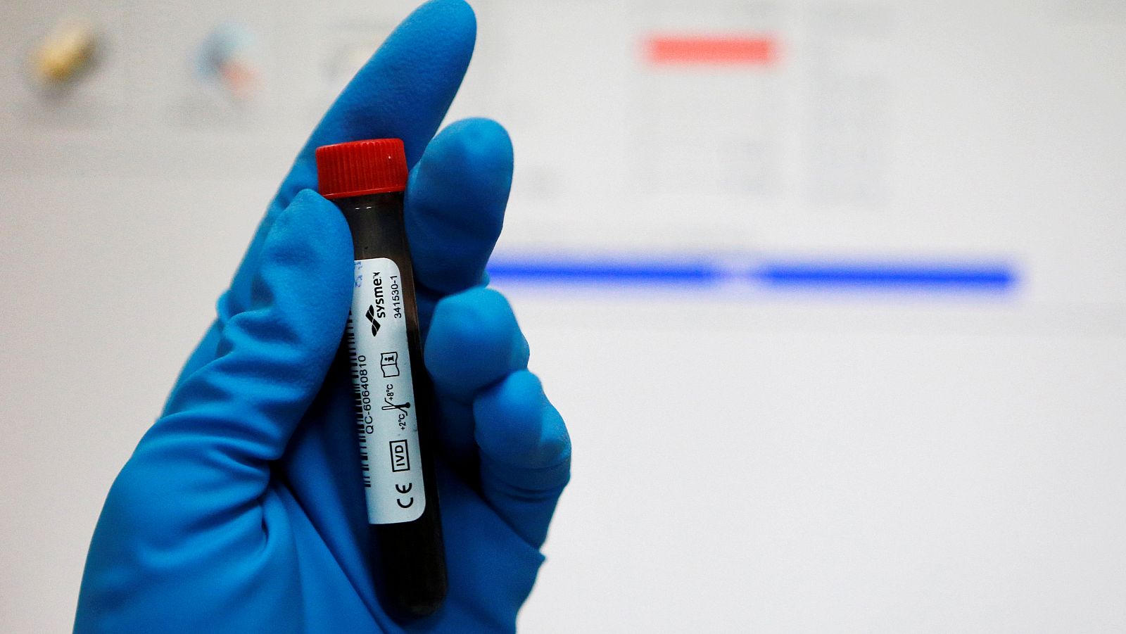 FILE PHOTO: A technician holds a test tube with a blood sample at the Russian anti-doping laboratory in Moscow