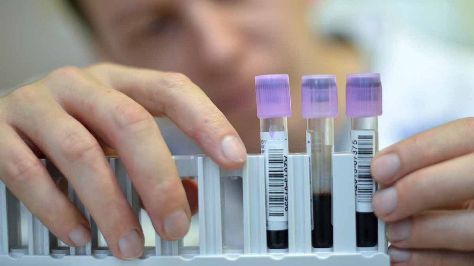 El análisis de sangre es capaz de detectar el cáncer de manera precoz.