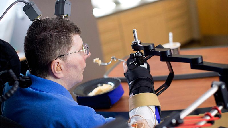 Un tetrapléjico vuelve a mover el brazo y la mano con la mente, gracias a una neuroprótesis