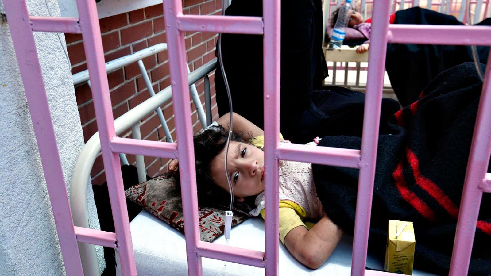 Varios niños enfermos de cólera son tratados en un hospital de Saná
