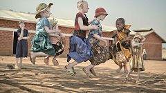 Albinos: la vida lejos del sol