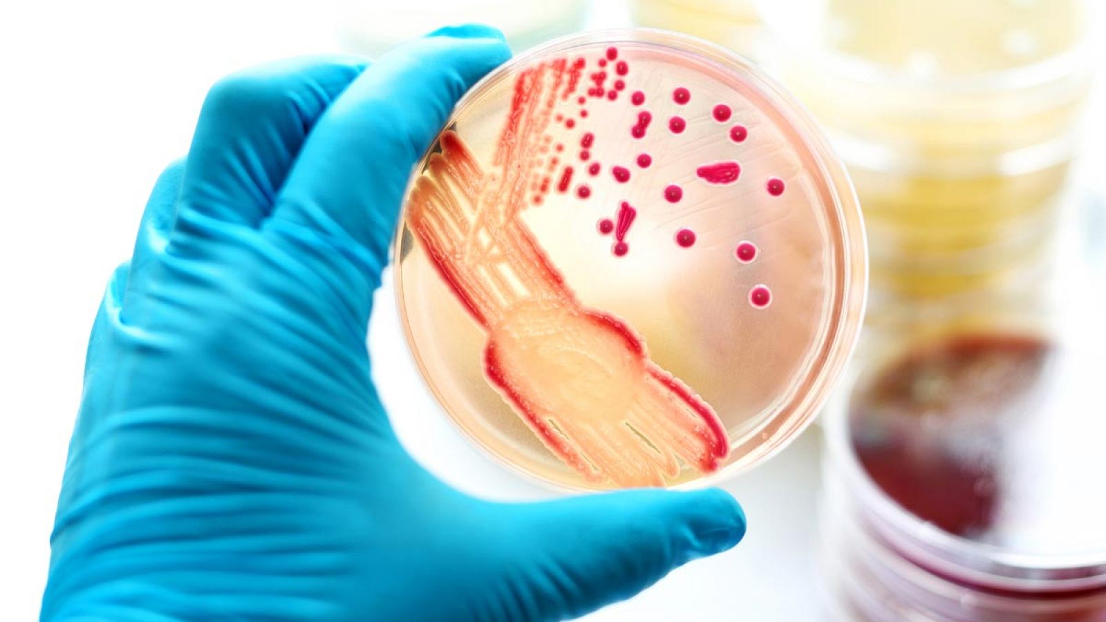 La OMS ha publicado un estudio que analiza los datos relativos al tratamiento de la gonorrea en 77 países.