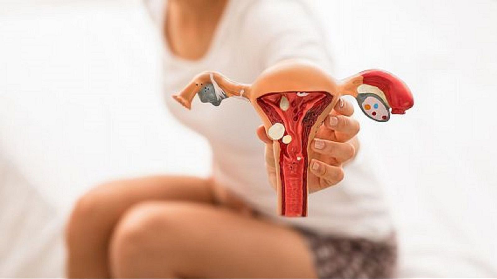 Com minimitzar les afectacions de l'endometriosi a les relacions sexuals.