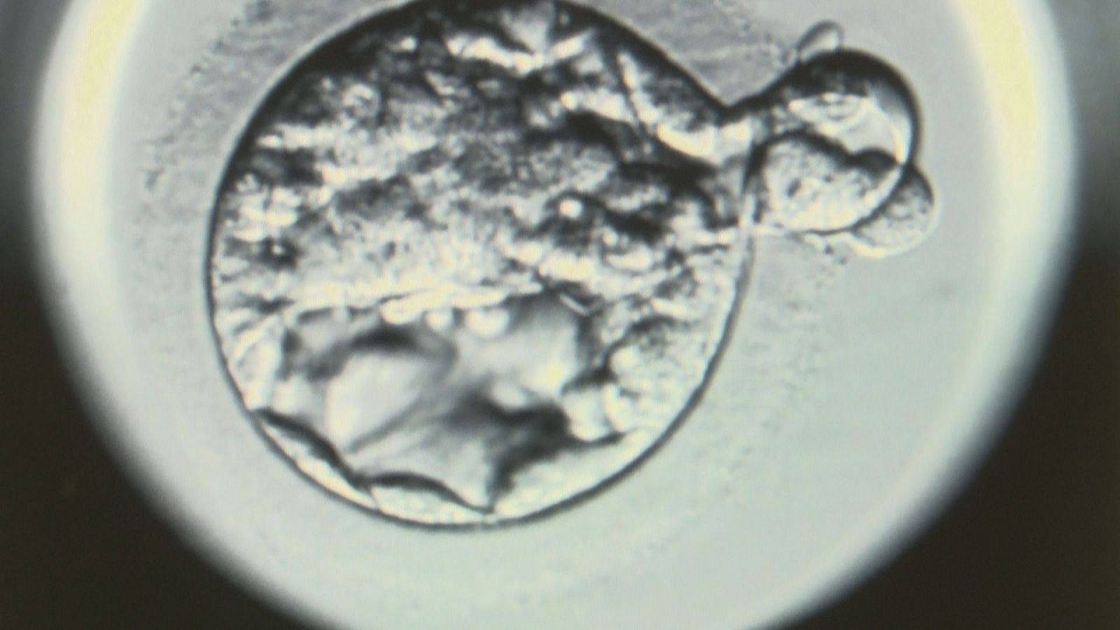 FOTO PORTADA ÓVULO POR MICROSCOPIO