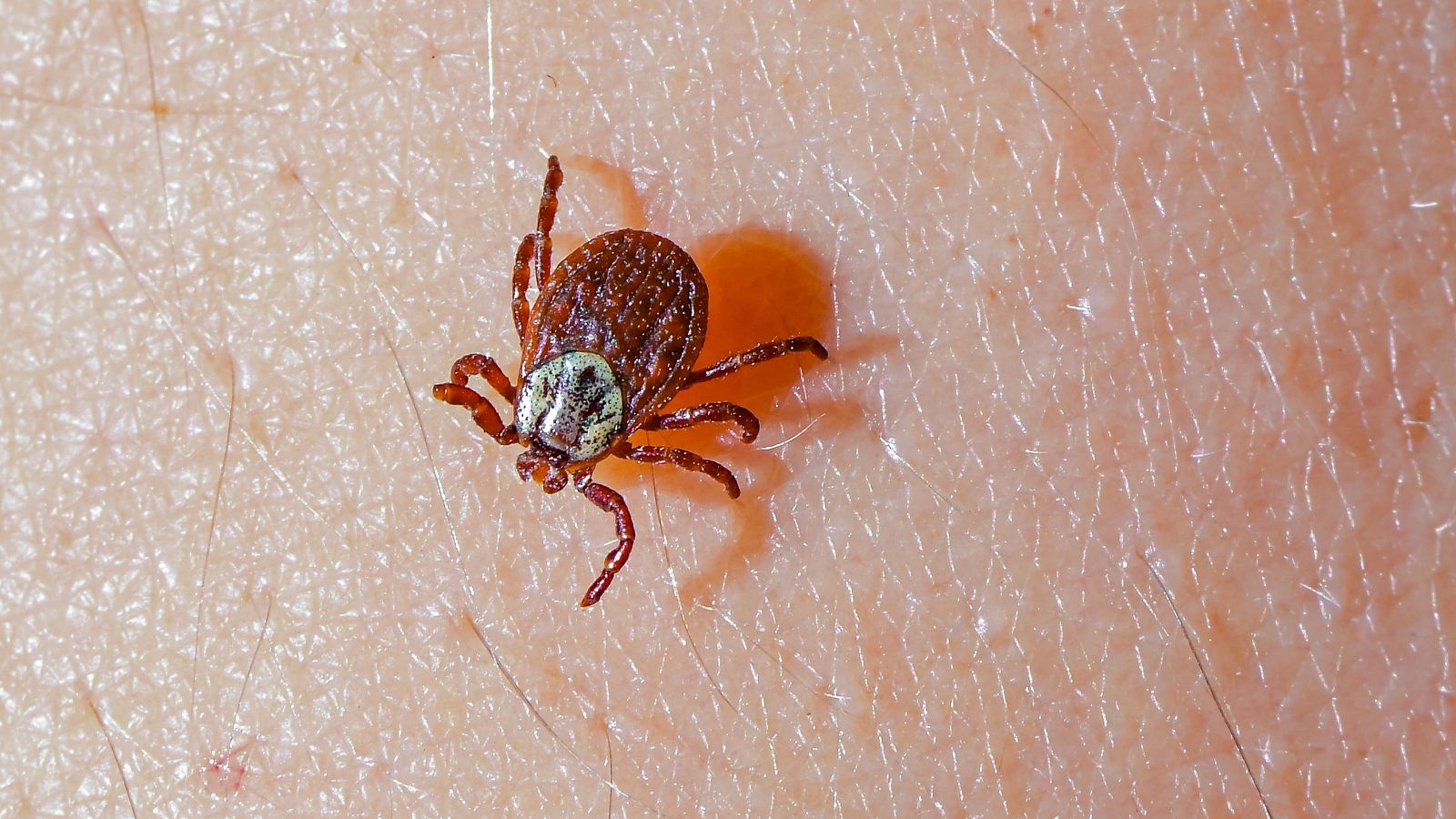 Muere un hombre en Salamanca por la fiebre de Crimea-Congo