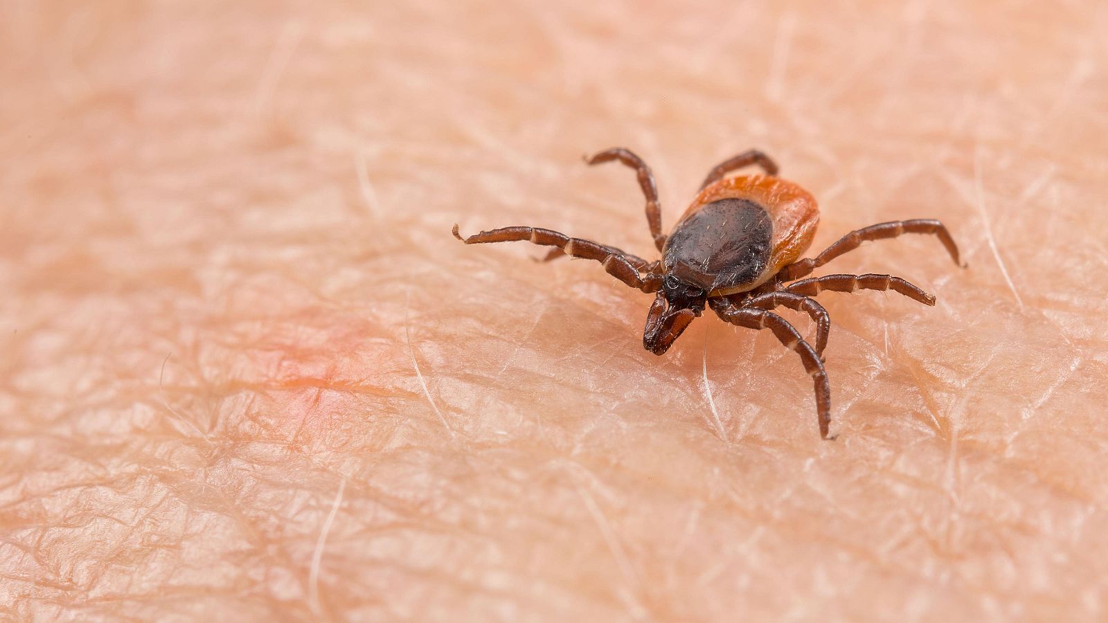 ¿Qués es la fiebre hemorrágica?