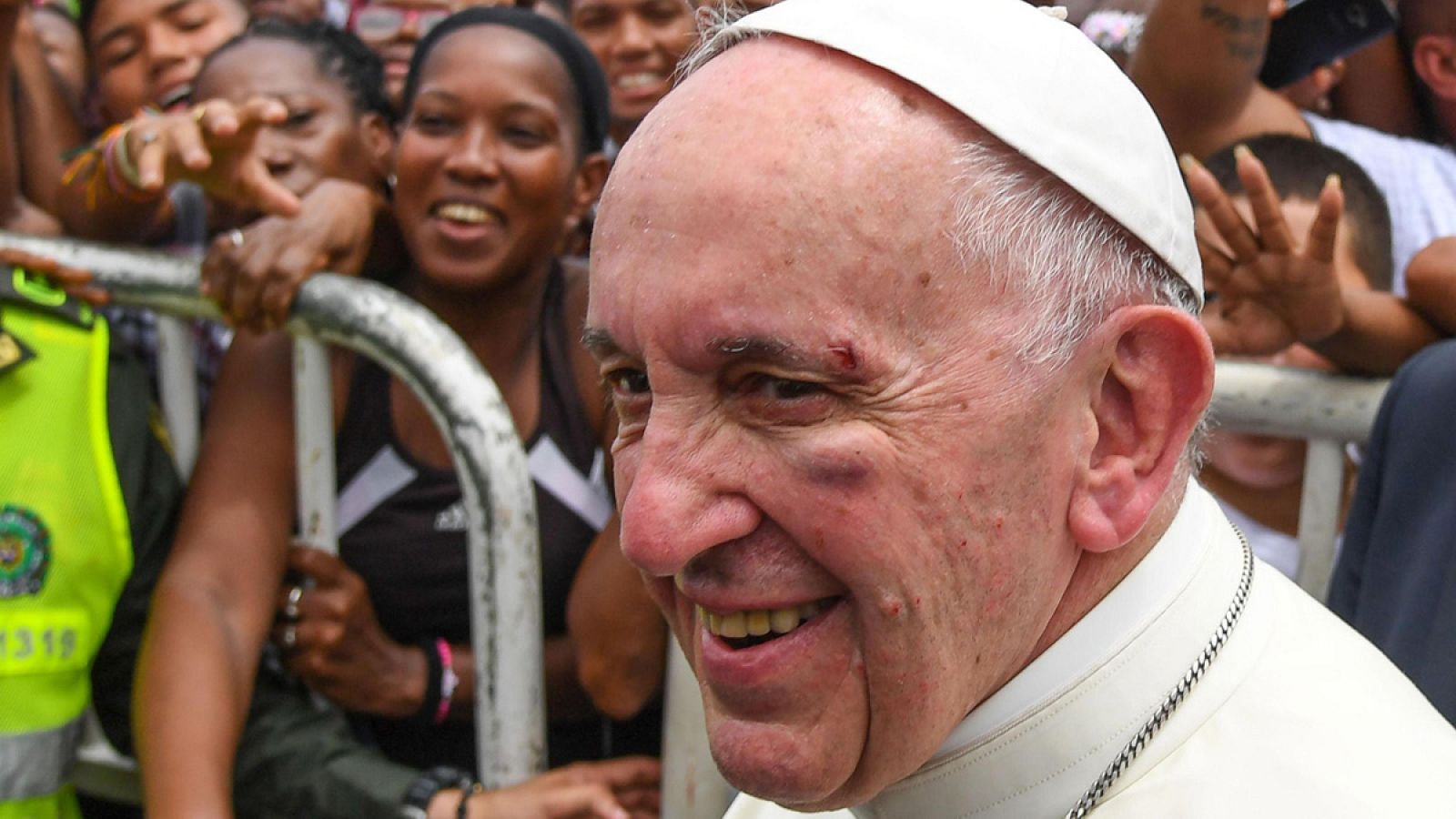 El papa se ha golpeado en la ceja y el pómulo izquierdos al intentar saludar a un niño
