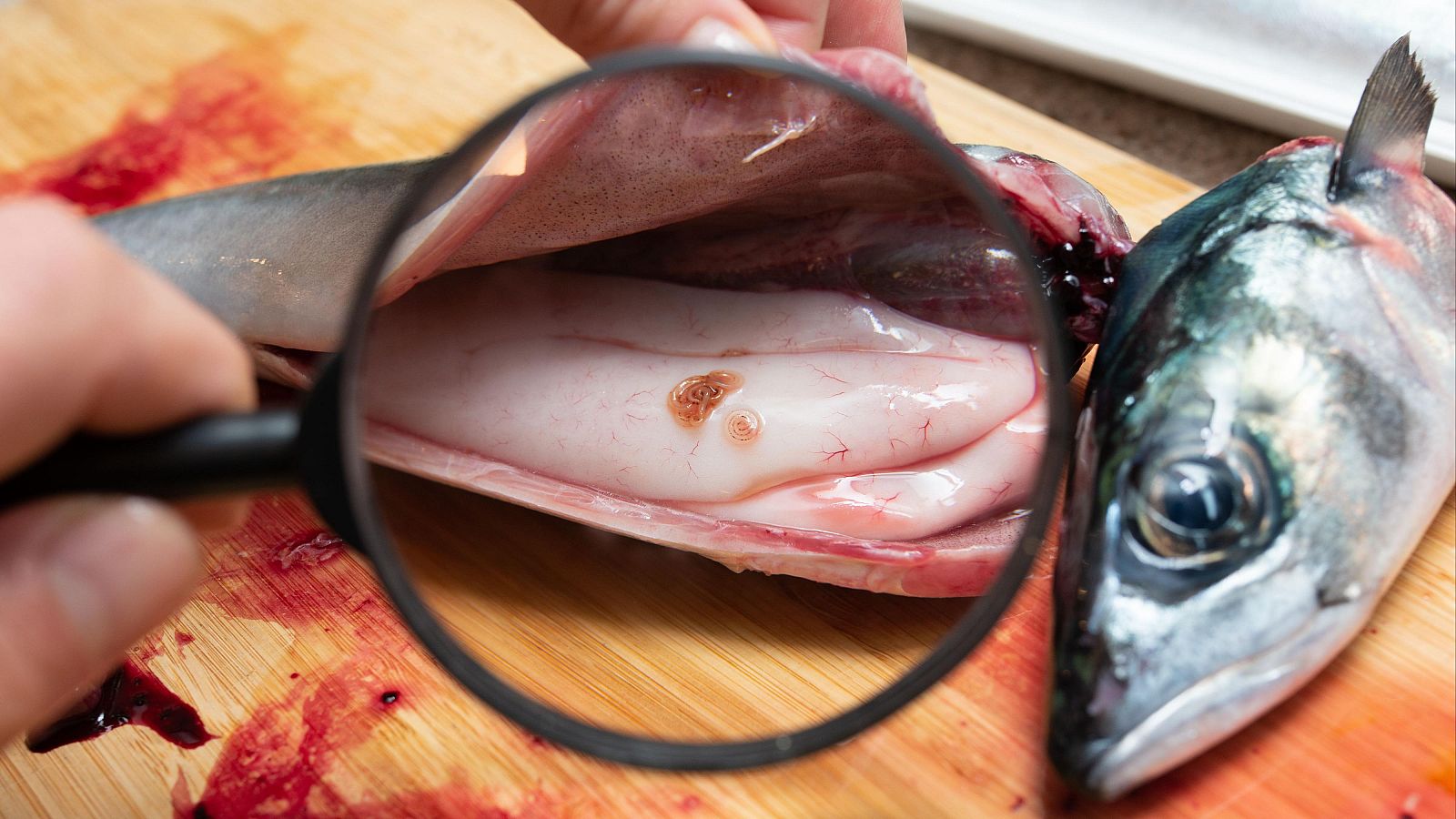 El parásito "anisakis" puede llegar a los humanos cuando se consume pescado crudo o poco cocinado.